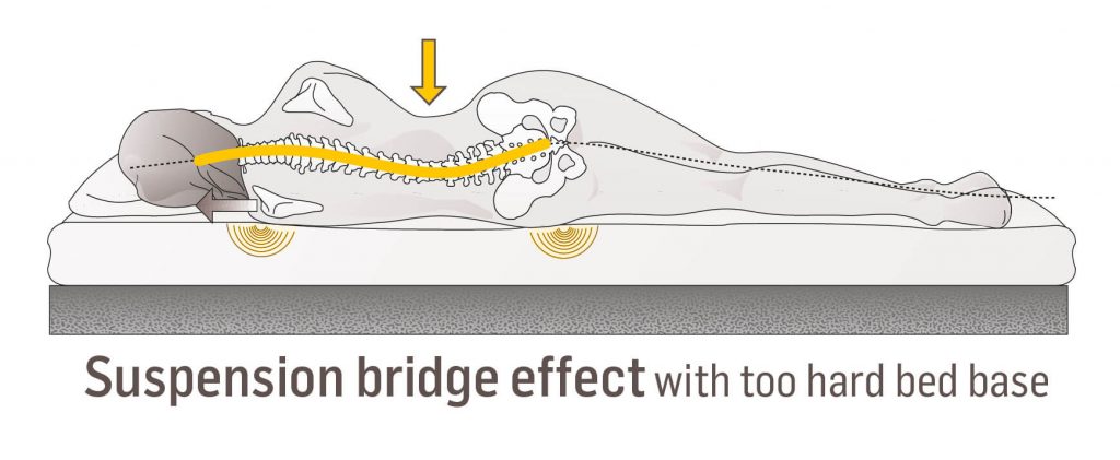 Do You Know Why You Wake Up With Lower Back Pain?