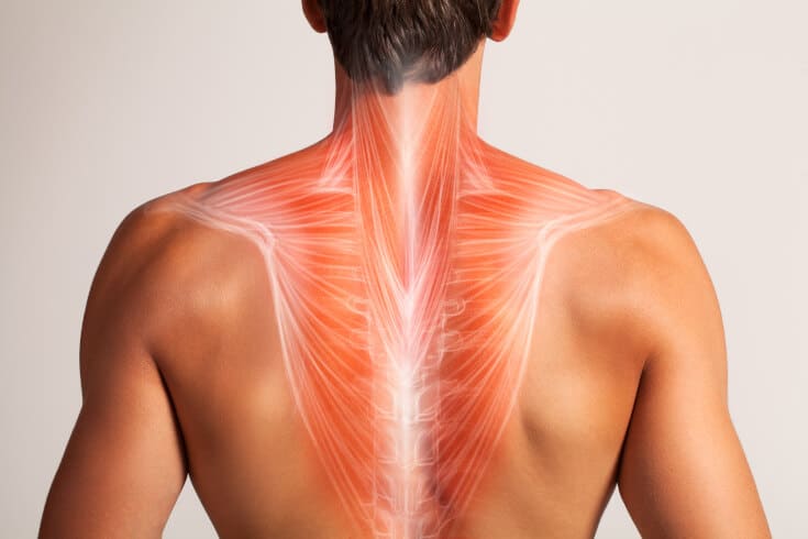 trapeziusspier