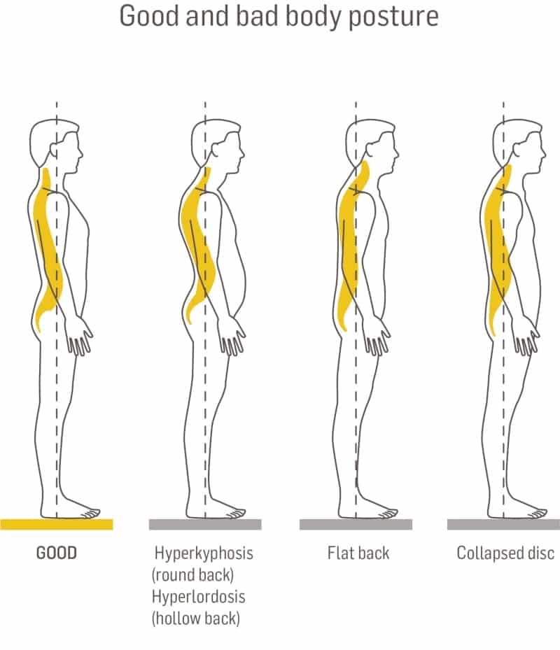 Back pain due to sedentary work: causes and tips - Dorsoo